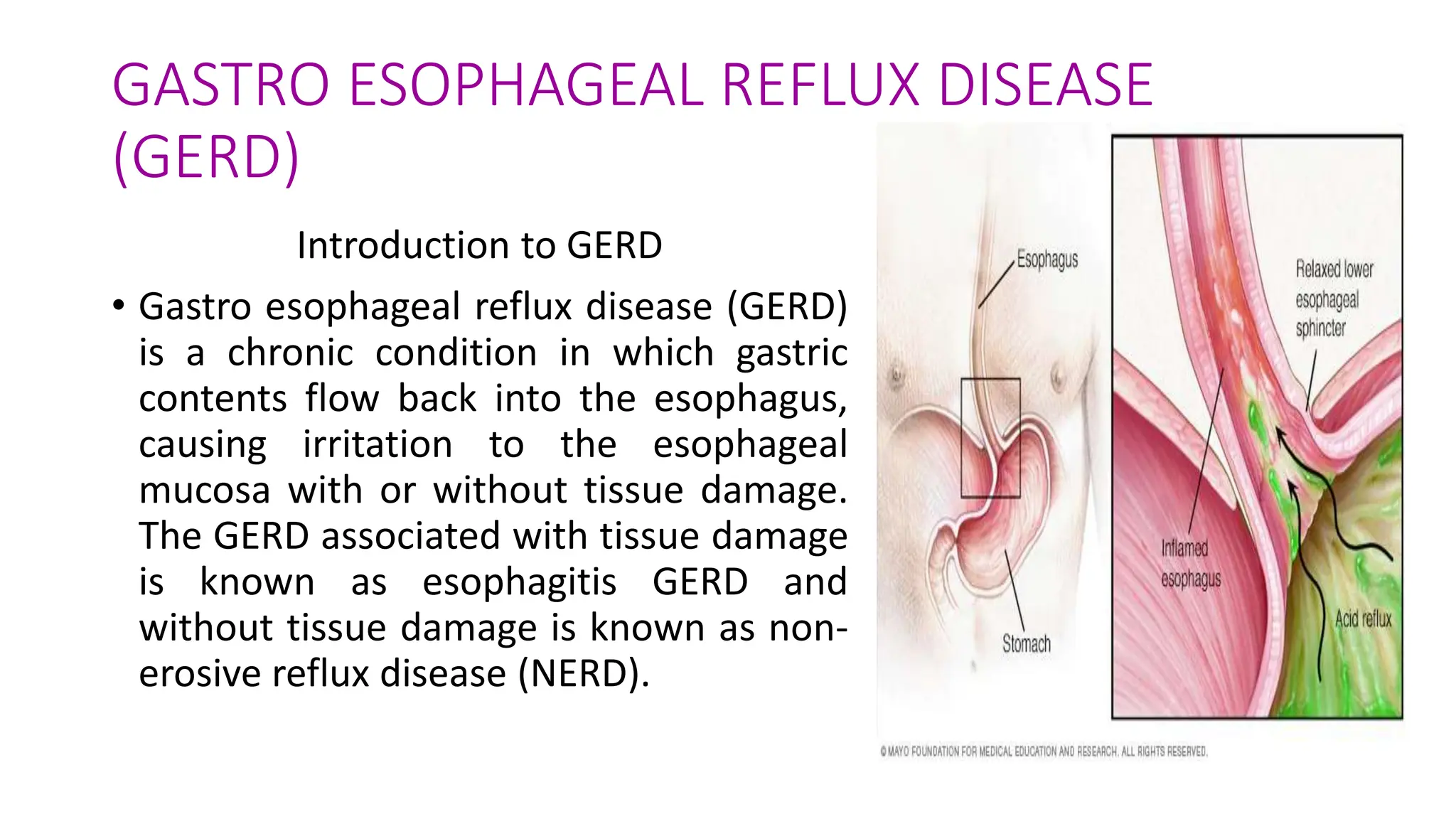 Chapter 6.Gastrointestinal Disorder.pptx | Digestive Disorders ...