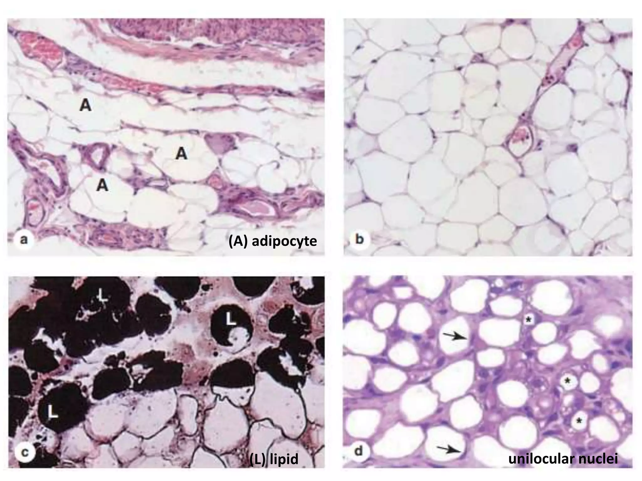 24
(A) adipocyte
(L) lipid unilocular nuclei
 