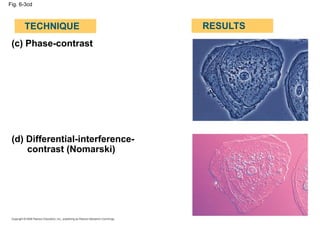 Fig. 6-3cd
(c) Phase-contrast
(d) Differential-interference-
contrast (Nomarski)
TECHNIQUE RESULTS
 