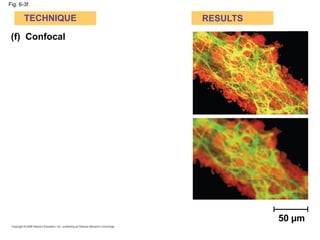Fig. 6-3f
(f) Confocal
TECHNIQUE RESULTS
50 µm
 
