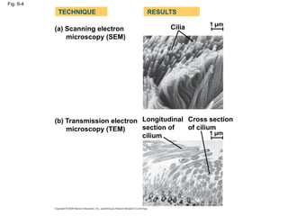 Fig. 6-4
(a) Scanning electron
microscopy (SEM)
TECHNIQUE RESULTS
(b) Transmission electron
microscopy (TEM)
Cilia
Longitudinal
section of
cilium
Cross section
of cilium
1 µm
1 µm
 
