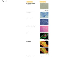 Fig. 6-3
TECHNIQUE RESULTS
(a) Brightfield (unstained
specimen)
(b) Brightfield (stained
specimen)
50 µm
(c) Phase-contrast
(d) Differential-interference-
contrast (Nomarski)
(e) Fluorescence
(f) Confocal
50 µm
50 µm
 