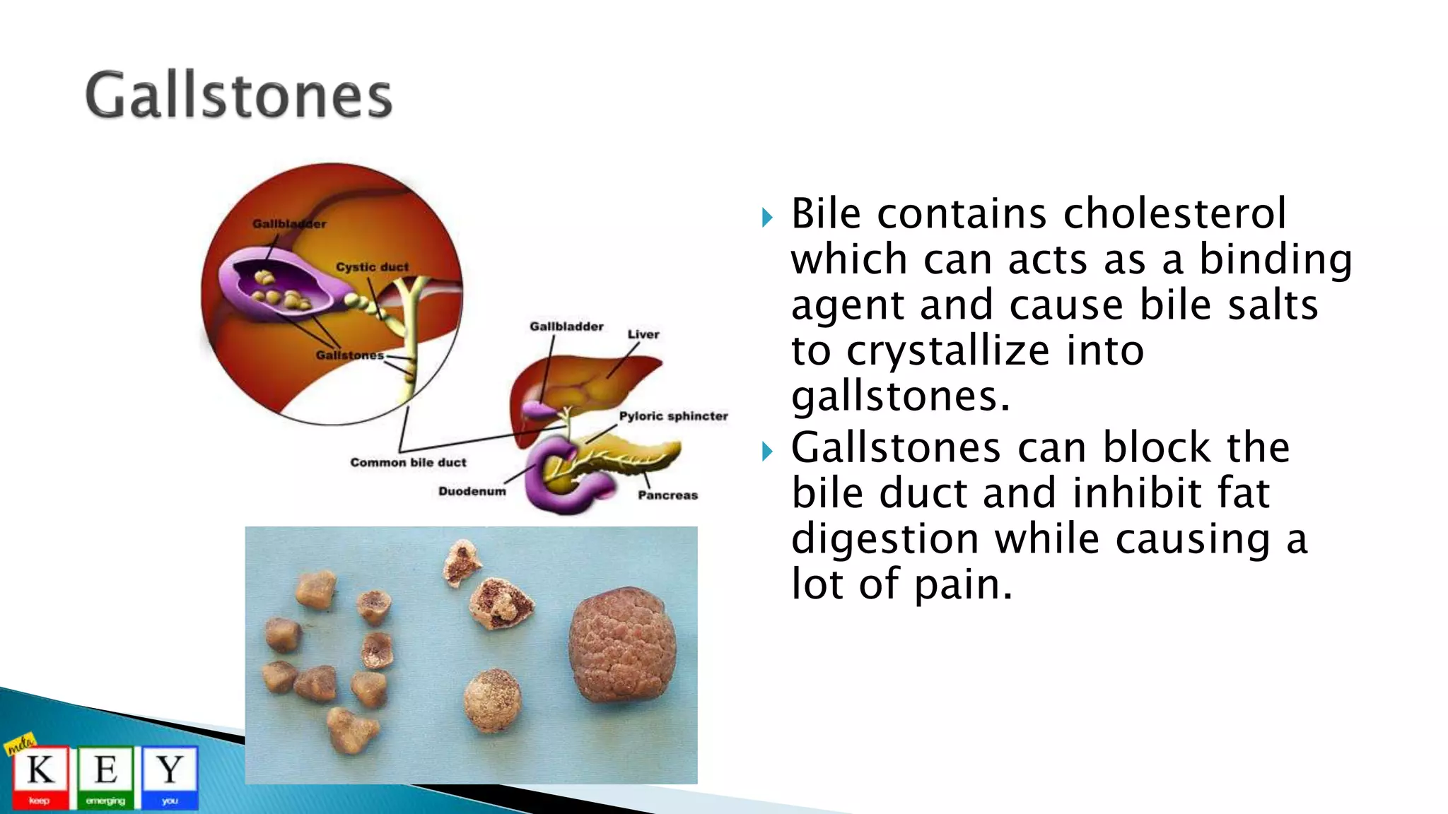  Bile contains cholesterol
which can acts as a binding
agent and cause bile salts
to crystallize into
gallstones.
 Gallstones can block the
bile duct and inhibit fat
digestion while causing a
lot of pain.
 