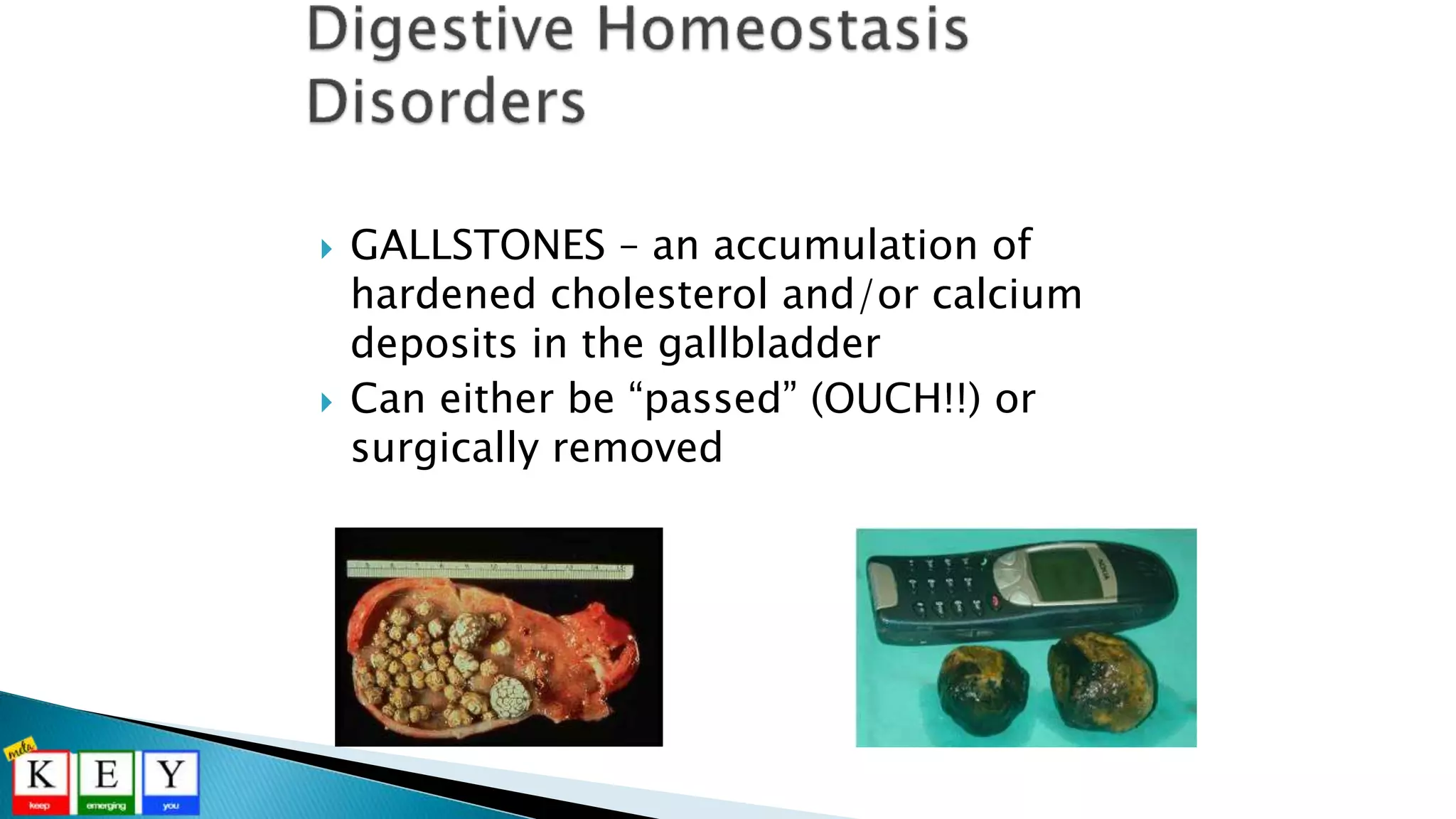  GALLSTONES – an accumulation of
hardened cholesterol and/or calcium
deposits in the gallbladder
 Can either be “passed” (OUCH!!) or
surgically removed
 