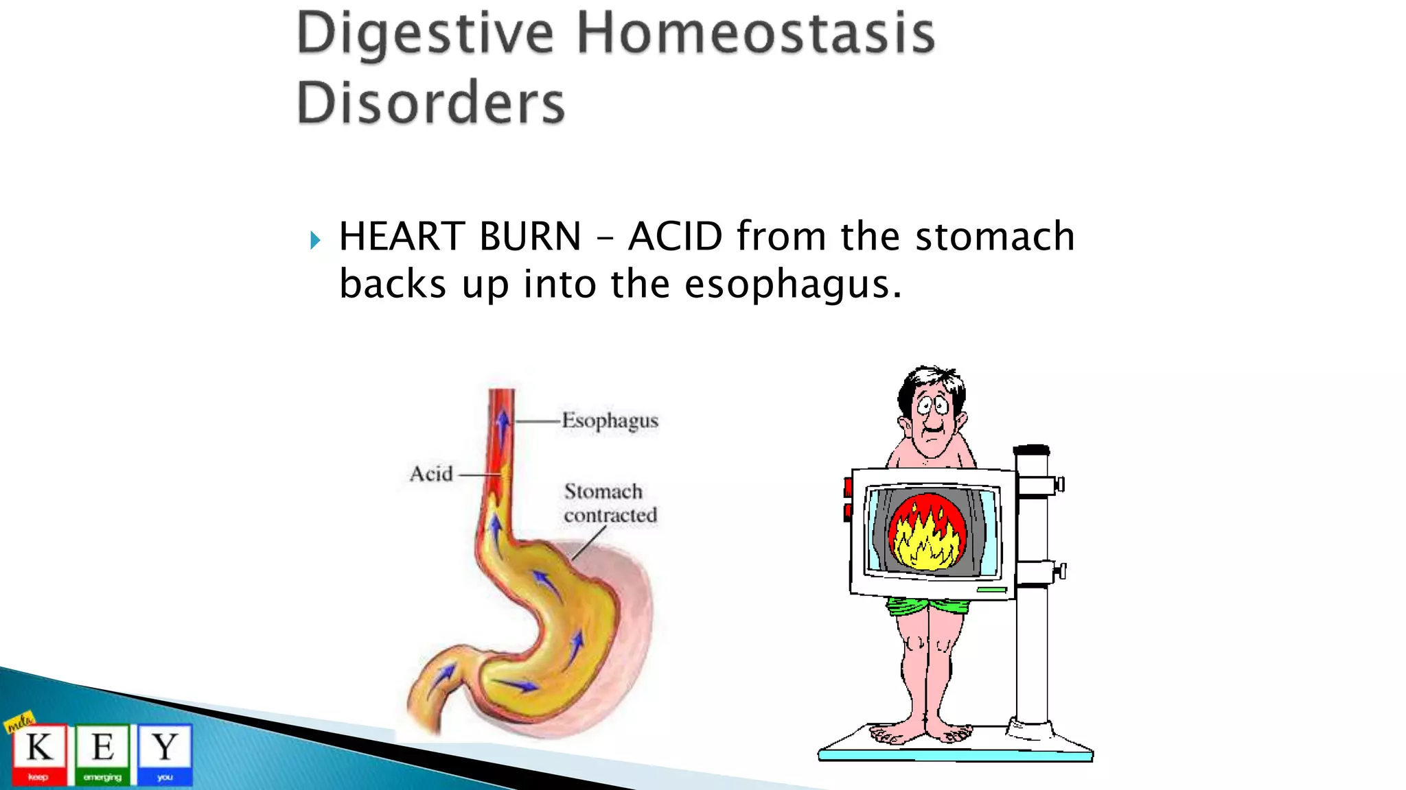  HEART BURN – ACID from the stomach
backs up into the esophagus.
 