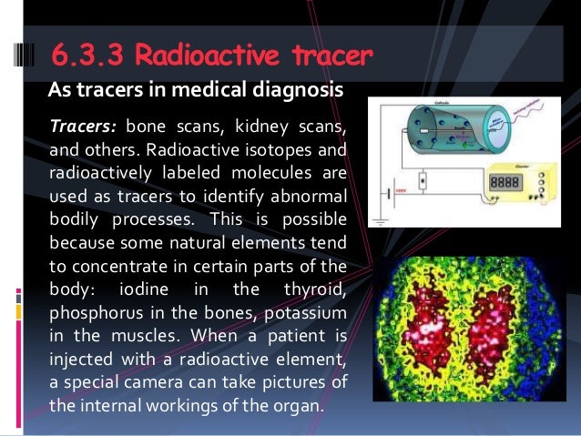 the process of bone scan imaging and radiocarbon dating are We know these steps because researchers followed the progress of carbon-14 throughout the process use radiocarbon dating to show that the pain of bone. the process of bone scan imaging and radiocarbon dating are We know these steps because researchers followed the progress of carbon-14 throughout the process use radiocarbon dating to show that the pain of bone.