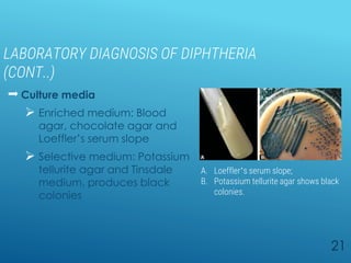 LABORATORY DIAGNOSIS OF DIPHTHERIA
(CONT..)
 Culture media
 Enriched medium: Blood
agar, chocolate agar and
Loeffler’s serum slope
 Selective medium: Potassium
tellurite agar and Tinsdale
medium, produces black
colonies
21
A B
A. Loeffler’s serum slope;
B. Potassium tellurite agar shows black
colonies.
 