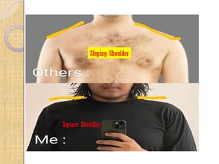 Square Shoulder
Sloping Shoulder
 