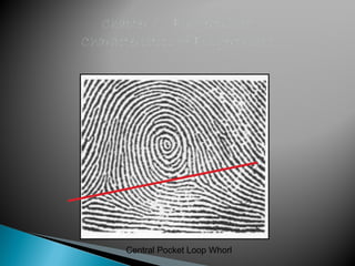 Center Pocket Loop Chapter 6 fingerprints power point | PPT