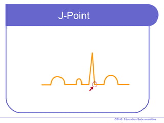 Chapter 6 - Introduction to 12 Lead Interpretation | PPT