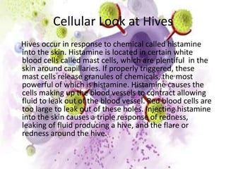 Cellular Look at Hives    Hives occur in response to chemical called histamine into the skin. Histamine is located in certain white blood cells called mast cells, which are plentiful  in the skin around capillaries. If properly triggered, these mast cells release granules of chemicals, the most powerful of which is histamine. Histamine causes the cells making up the blood vessels to contract allowing fluid to leak out of the blood vessel. Red blood cells are too large to leak out of these holes. Injecting histamine into the skin causes a triple response of redness, leaking of fluid producing a hive, and the flare or redness around the hive. 