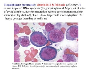 Chapter 6_Pt2_RBC_Catabolism_Instrumentation in hematology.ppt