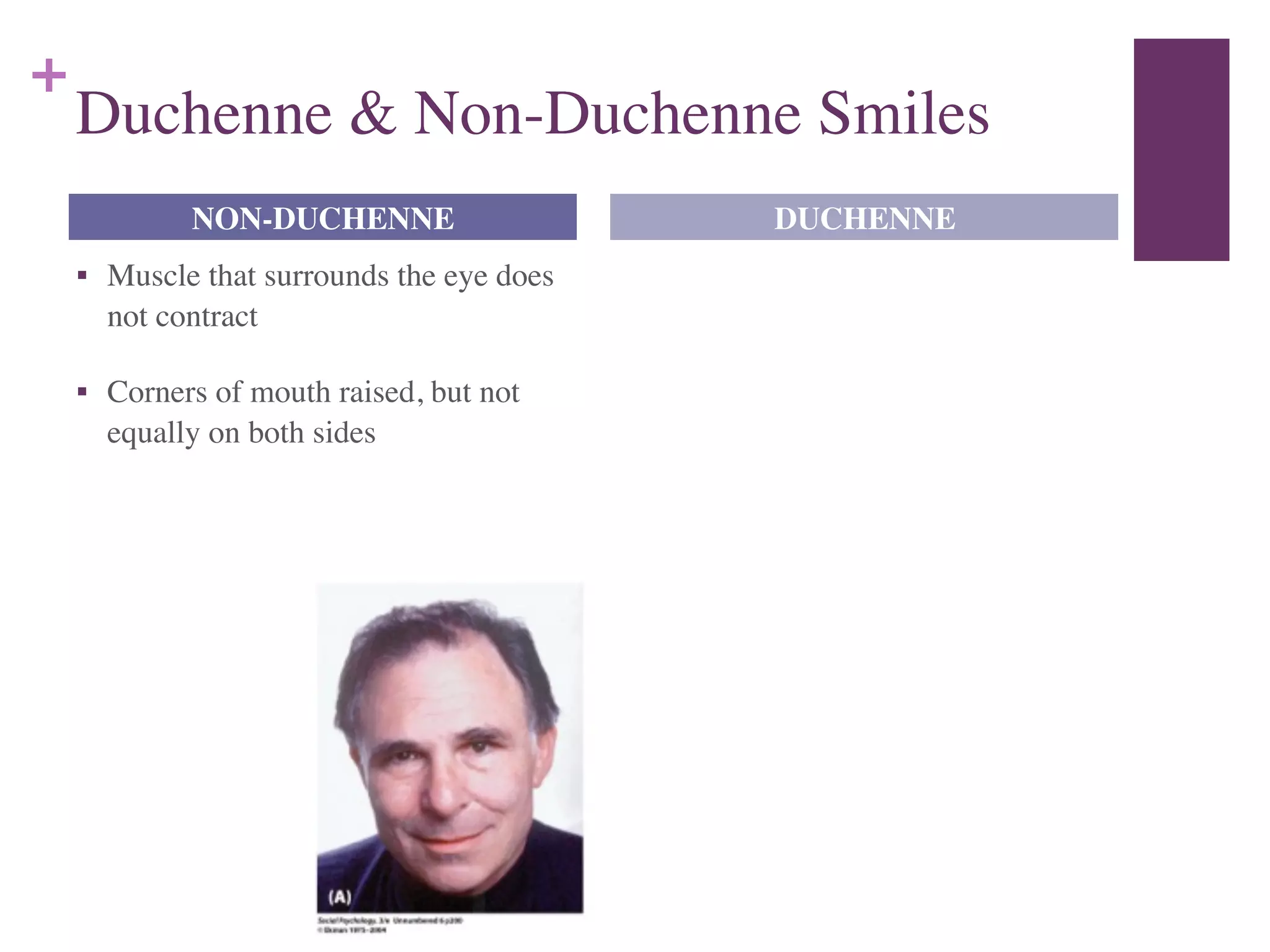 +
Duchenne & Non-Duchenne Smiles
■ Muscle that surrounds the eye does
not contract	

■ Corners of mouth raised, but not
equally on both sides
NON-DUCHENNE DUCHENNE
 