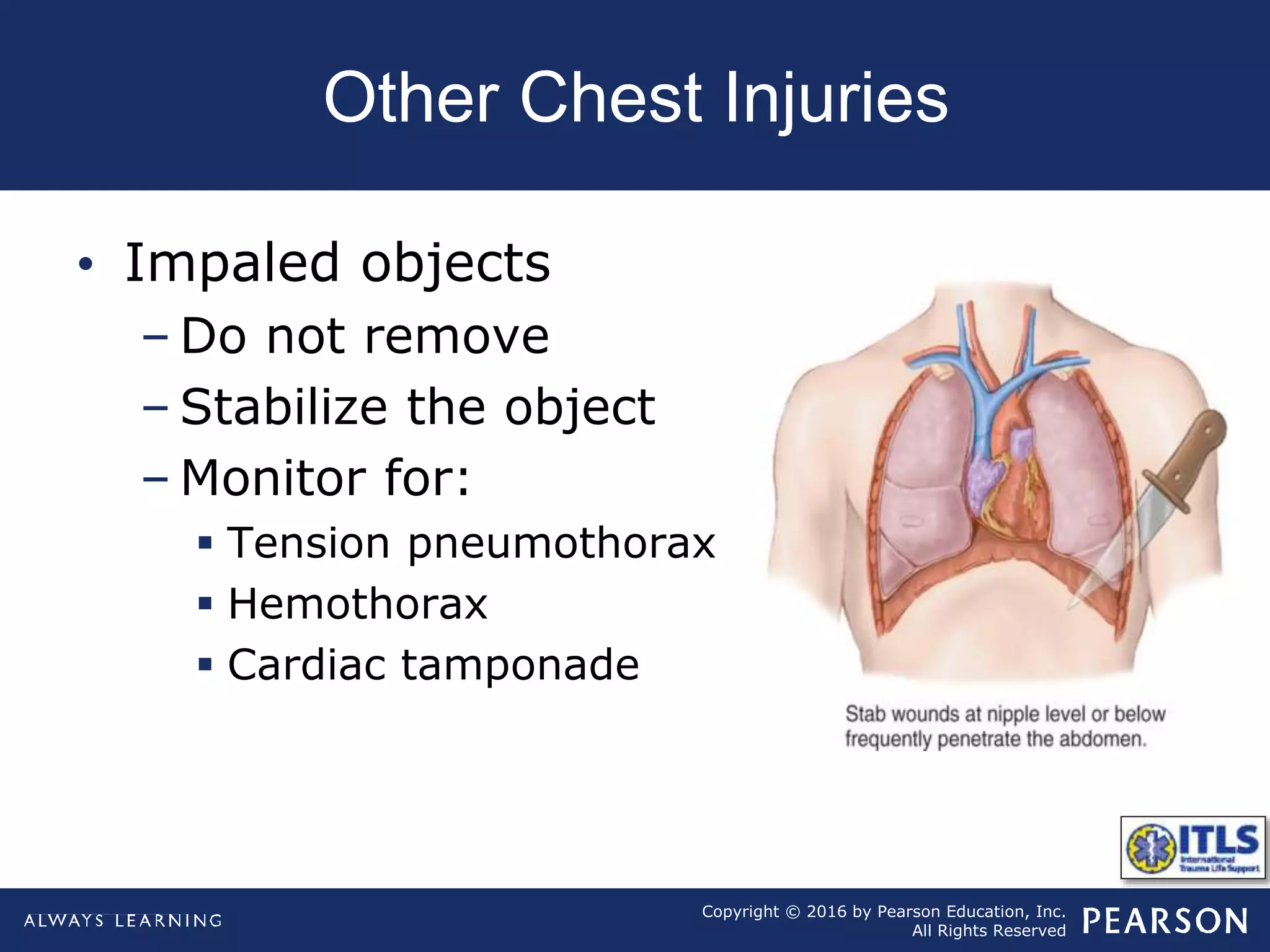 Impaled Object Example Chapter6 thoracic trauma | PPT
