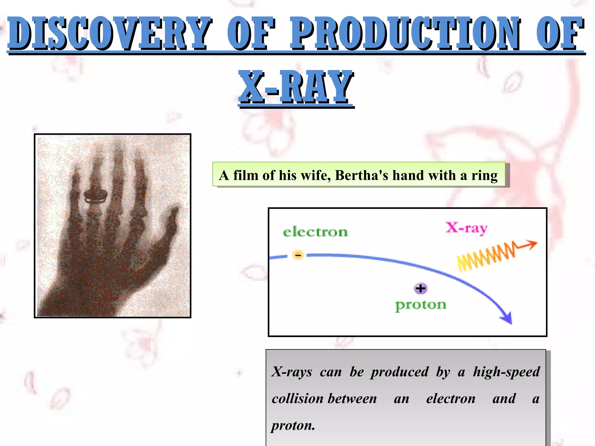 DISCOVERY OF PRODUCTION OF
X-RAY
A film of his wife, Bertha's hand with aaring
A film of his wife, Bertha's hand with ring

X-rays can be produced by aa high-speed
X-rays can be produced by
high-speed
collision between an electron and aa
collision between an electron and
proton.
proton.

 