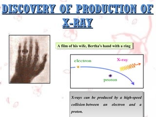 Chapter 6 x ray | PPT