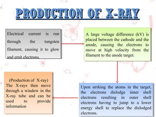 PRODUCTION OF X-RAY
Electrical current is run
Electrical current is run
through
through

the
the

tungsten
tungsten

filament, causing it to glow
filament, causing it to glow
and emit electrons.
and emit electrons.

(Production of X-ray)
(Production of X-ray)
The X-rays then move
The X-rays then move
through aa window in the
through window in the
X-ray tube and can be
X-ray tube and can be
used
to
provide
used
to
provide
information
information

A large voltage difference (kV) is
A large voltage difference (kV) is
placed between the cathode and the
placed between the cathode and the
anode, causing the electrons to
anode, causing the electrons to
move at high velocity from the
move at high velocity from the
filament to the anode target. . 
filament to the anode target

Upon striking the atoms in the target,
Upon striking the atoms in the target,
the electrons dislodge inner shell
the electrons dislodge inner shell
electrons resulting in outer shell
electrons resulting in outer shell
electrons having to jump to aa lower
electrons having to jump to
lower
energy shell to replace the dislodged
energy shell to replace the dislodged
electrons.
electrons.

 