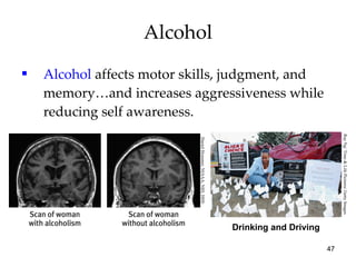Alcohol Alcohol   affects motor skills, judgment, and memory…and increases aggressiveness while reducing self awareness. Drinking and Driving Daniel Hommer, NIAAA, NIH, HHS Ray Ng/ Time & Life Pictures/ Getty Images 