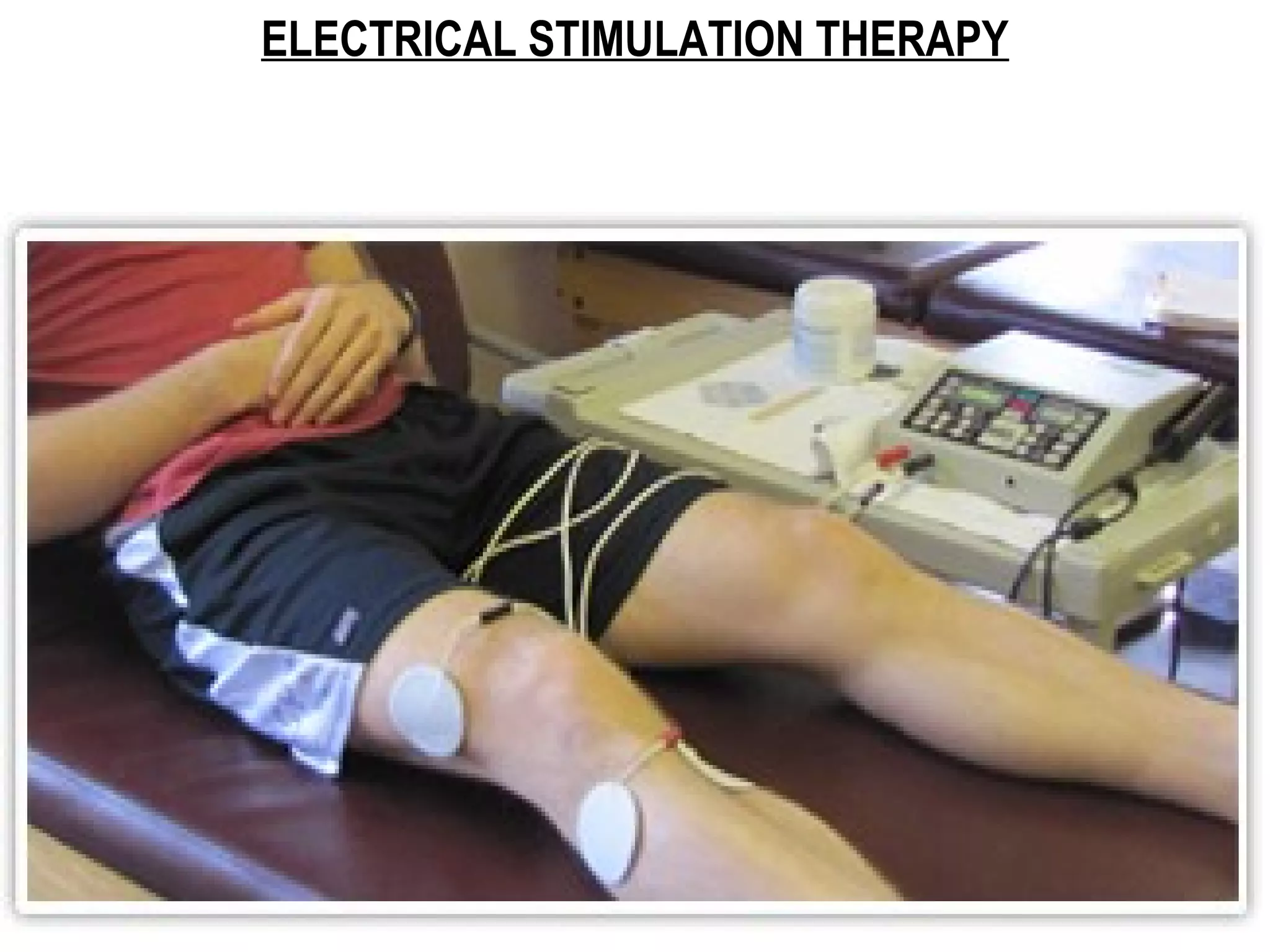 ELECTRICAL STIMULATION THERAPY
 