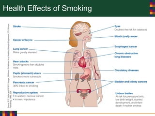Health Effects of Smoking
 