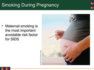 Smoking During Pregnancy
• Maternal smoking is
the most important
avoidable risk factor
for SIDS
 