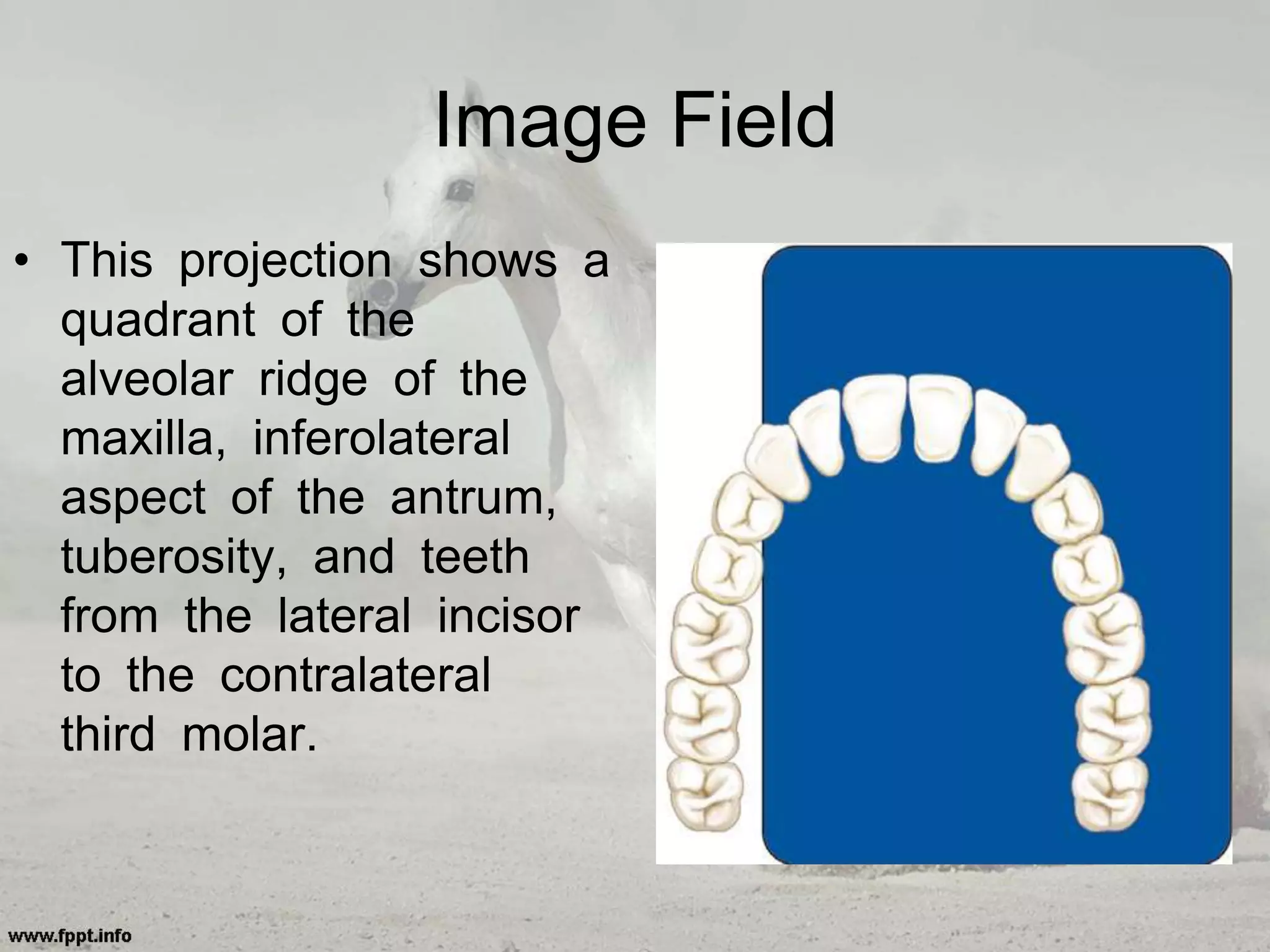 Image Field
• This projection shows a
quadrant of the
alveolar ridge of the
maxilla, inferolateral
aspect of the antrum,
tuberosity, and teeth
from the lateral incisor
to the contralateral
third molar.
 
