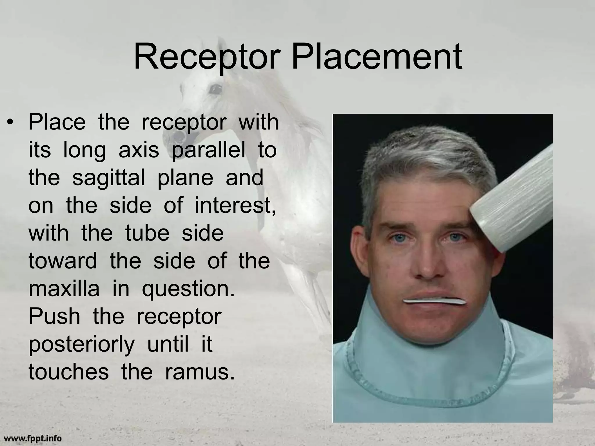 Receptor Placement
• Place the receptor with
its long axis parallel to
the sagittal plane and
on the side of interest,
with the tube side
toward the side of the
maxilla in question.
Push the receptor
posteriorly until it
touches the ramus.
 