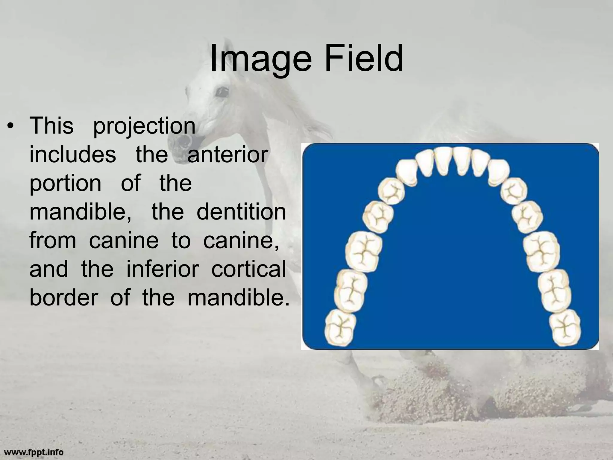 Image Field
• This projection
includes the anterior
portion of the
mandible, the dentition
from canine to canine,
and the inferior cortical
border of the mandible.
 