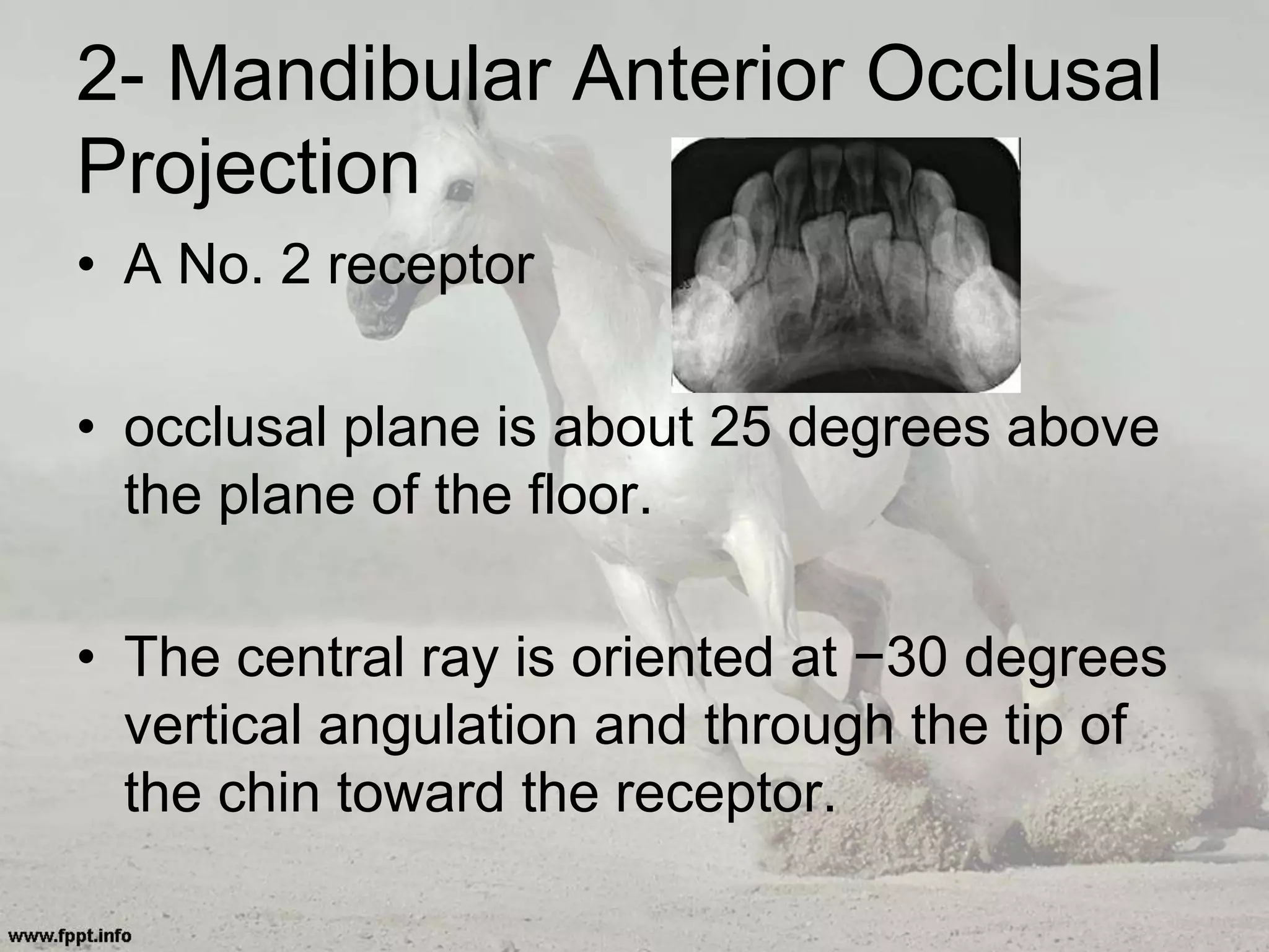 2- Mandibular Anterior Occlusal
Projection
• A No. 2 receptor
• occlusal plane is about 25 degrees above
the plane of the floor.
• The central ray is oriented at −30 degrees
vertical angulation and through the tip of
the chin toward the receptor.
 