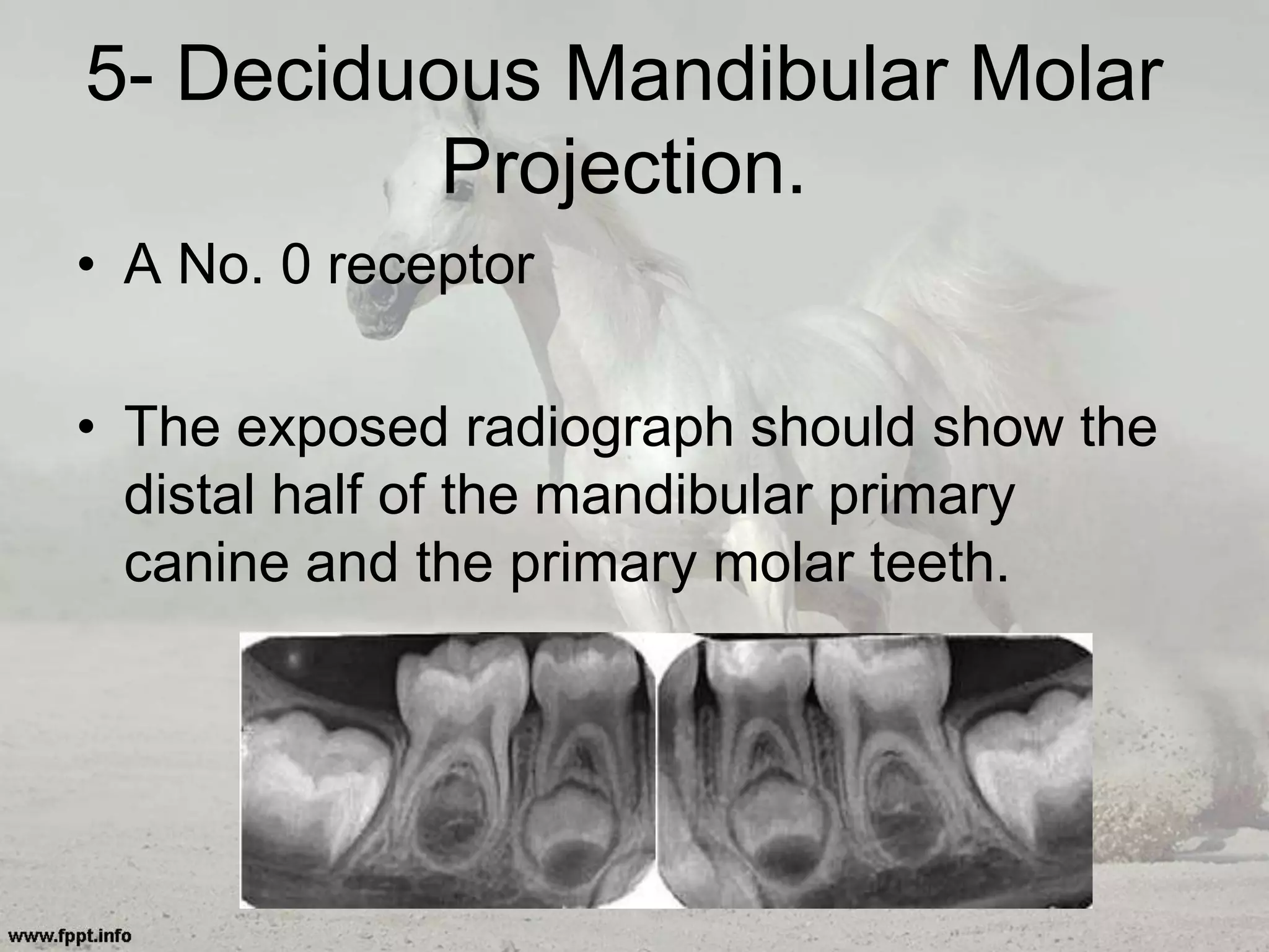 5- Deciduous Mandibular Molar
Projection.
• A No. 0 receptor
• The exposed radiograph should show the
distal half of the mandibular primary
canine and the primary molar teeth.
 