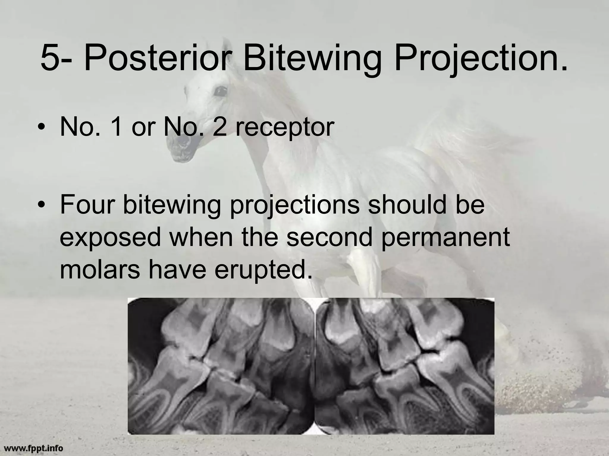 5- Posterior Bitewing Projection.
• No. 1 or No. 2 receptor
• Four bitewing projections should be
exposed when the second permanent
molars have erupted.
 