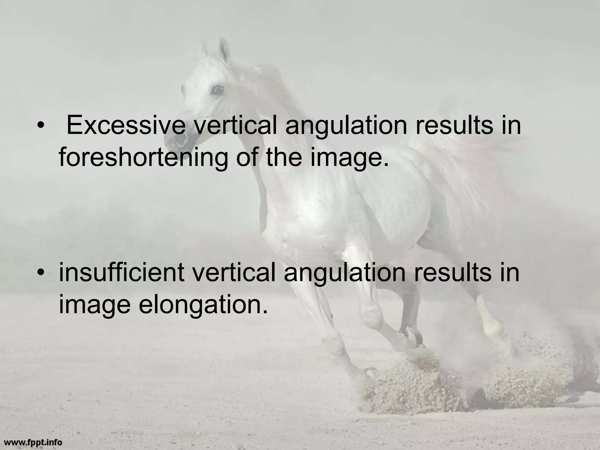 • Excessive vertical angulation results in
foreshortening of the image.
• insufficient vertical angulation results in
image elongation.
 