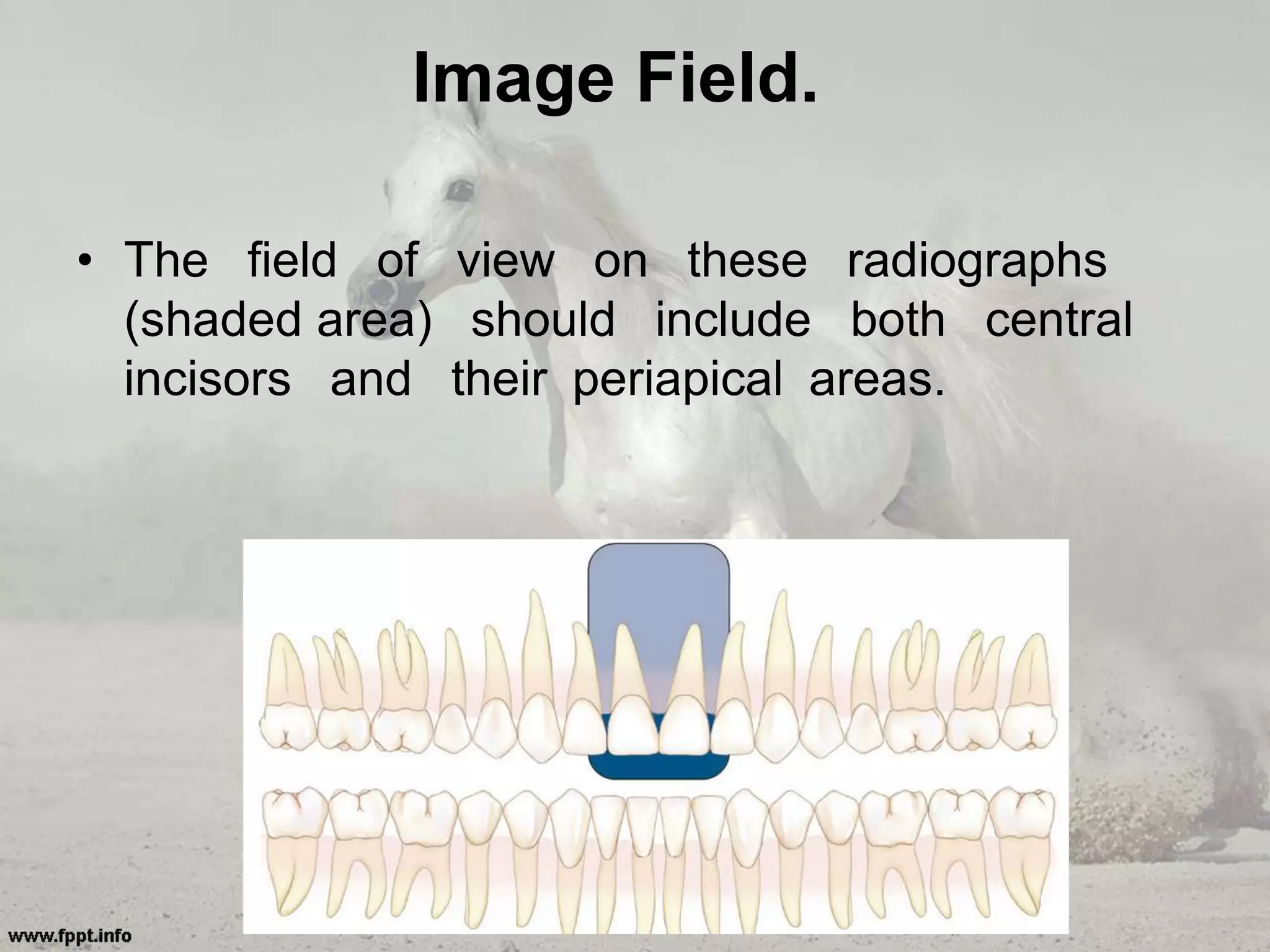 Image Field.
• The field of view on these radiographs
(shaded area) should include both central
incisors and their periapical areas.
 