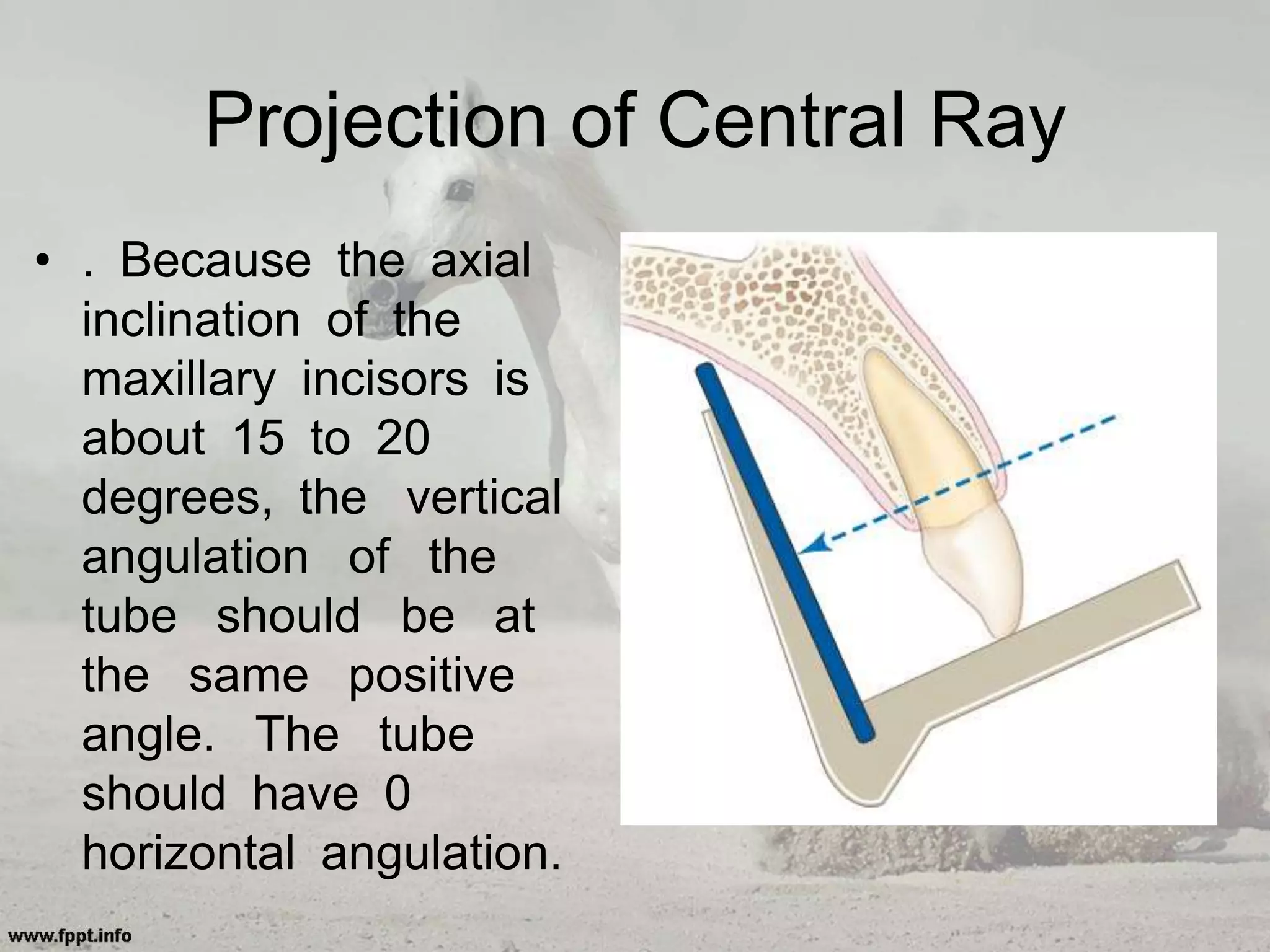 Projection of Central Ray
• . Because the axial
inclination of the
maxillary incisors is
about 15 to 20
degrees, the vertical
angulation of the
tube should be at
the same positive
angle. The tube
should have 0
horizontal angulation.
 