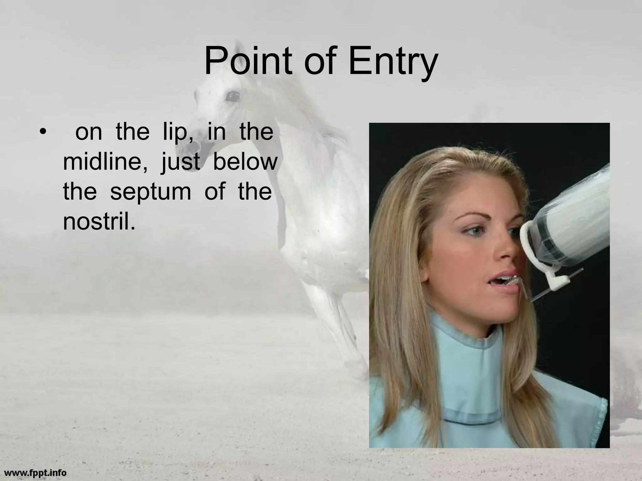 Point of Entry
• on the lip, in the
midline, just below
the septum of the
nostril.
 
