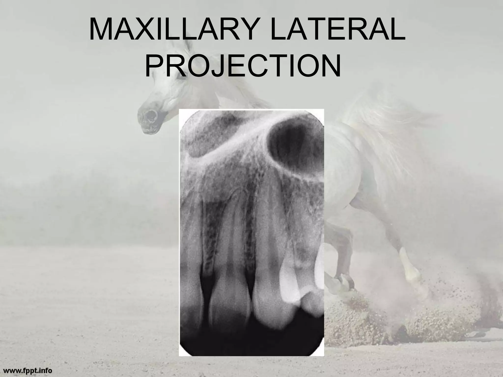 MAXILLARY LATERAL
PROJECTION
 