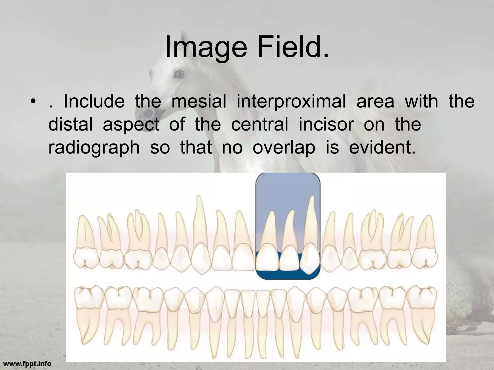 Image Field.
• . Include the mesial interproximal area with the
distal aspect of the central incisor on the
radiograph so that no overlap is evident.
 