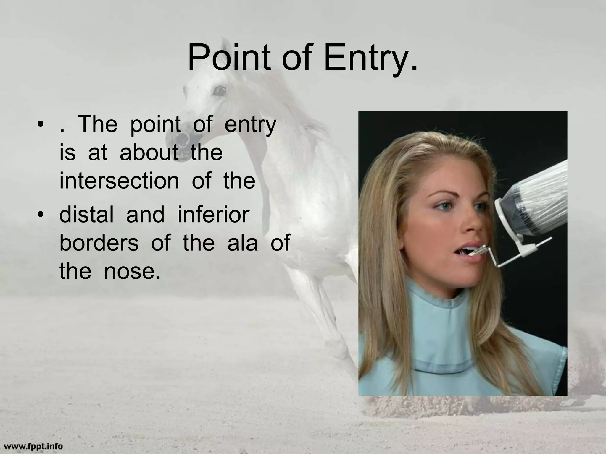 Point of Entry.
• . The point of entry
is at about the
intersection of the
• distal and inferior
borders of the ala of
the nose.
 
