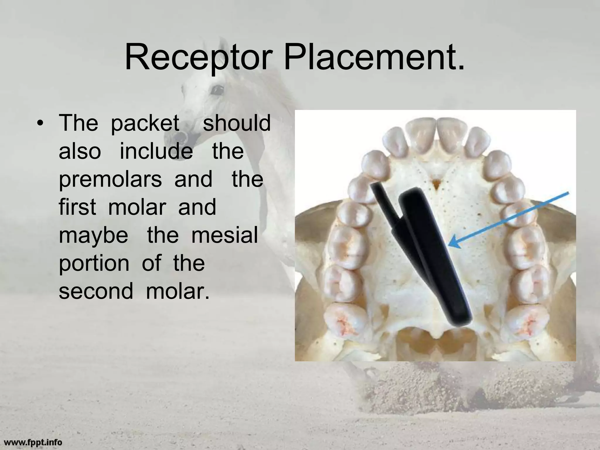 Receptor Placement.
• The packet should
also include the
premolars and the
first molar and
maybe the mesial
portion of the
second molar.
 