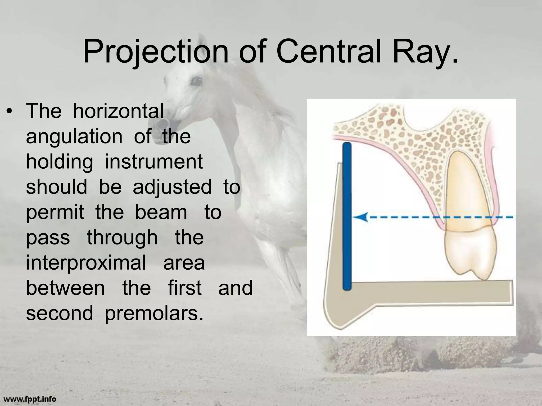 Projection of Central Ray.
• The horizontal
angulation of the
holding instrument
should be adjusted to
permit the beam to
pass through the
interproximal area
between the first and
second premolars.
 