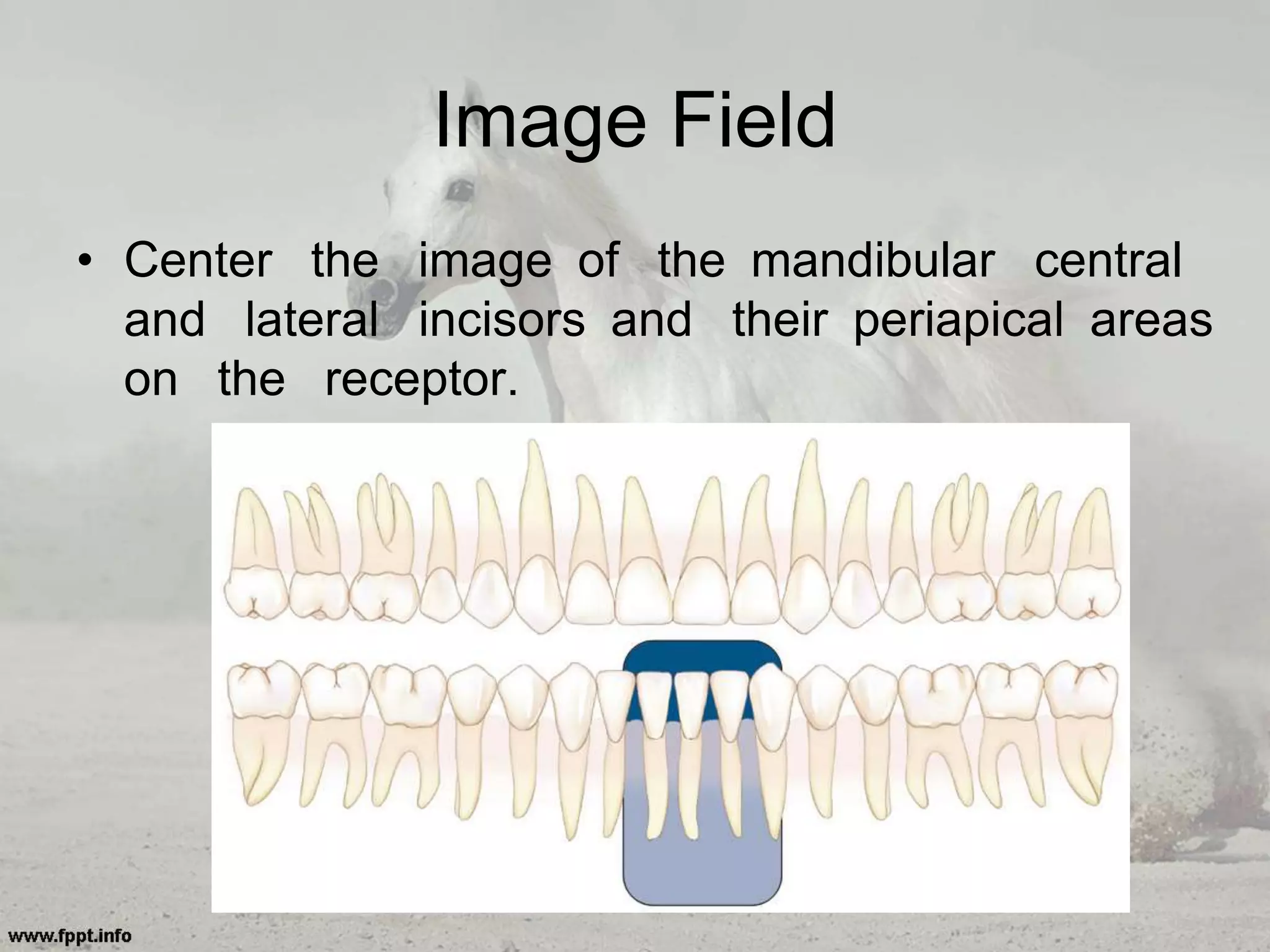 Image Field
• Center the image of the mandibular central
and lateral incisors and their periapical areas
on the receptor.
 