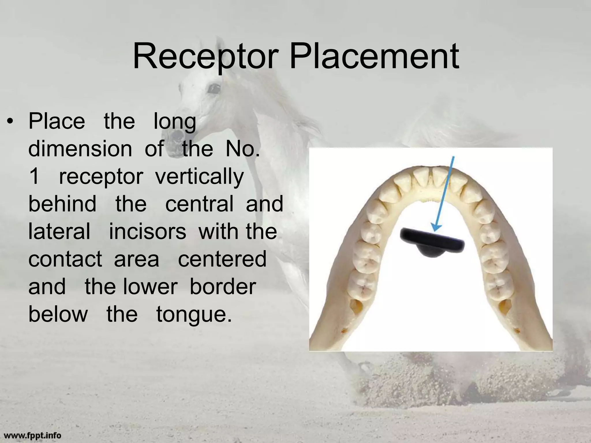 Receptor Placement
• Place the long
dimension of the No.
1 receptor vertically
behind the central and
lateral incisors with the
contact area centered
and the lower border
below the tongue.
 
