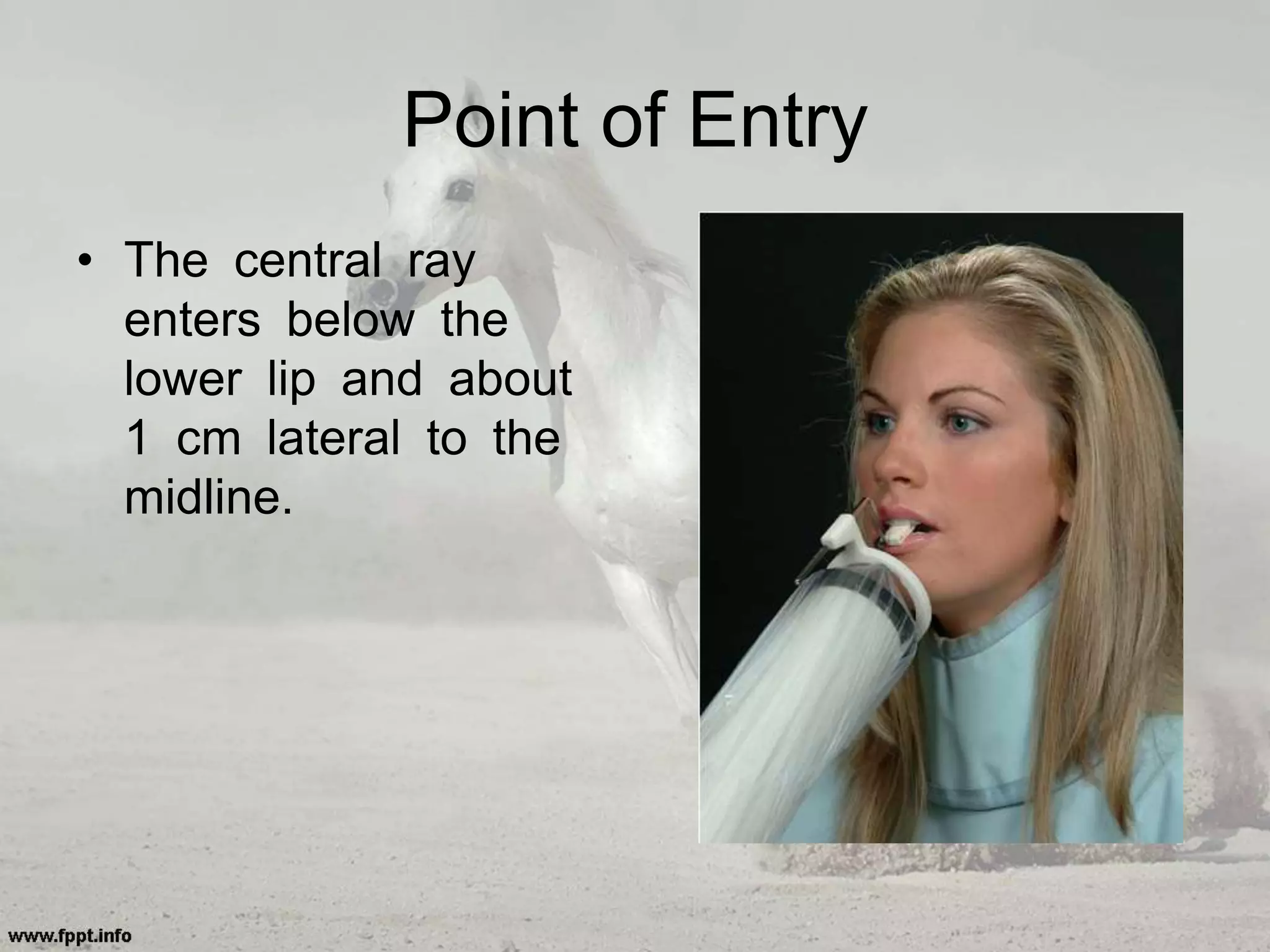 Point of Entry
• The central ray
enters below the
lower lip and about
1 cm lateral to the
midline.
 