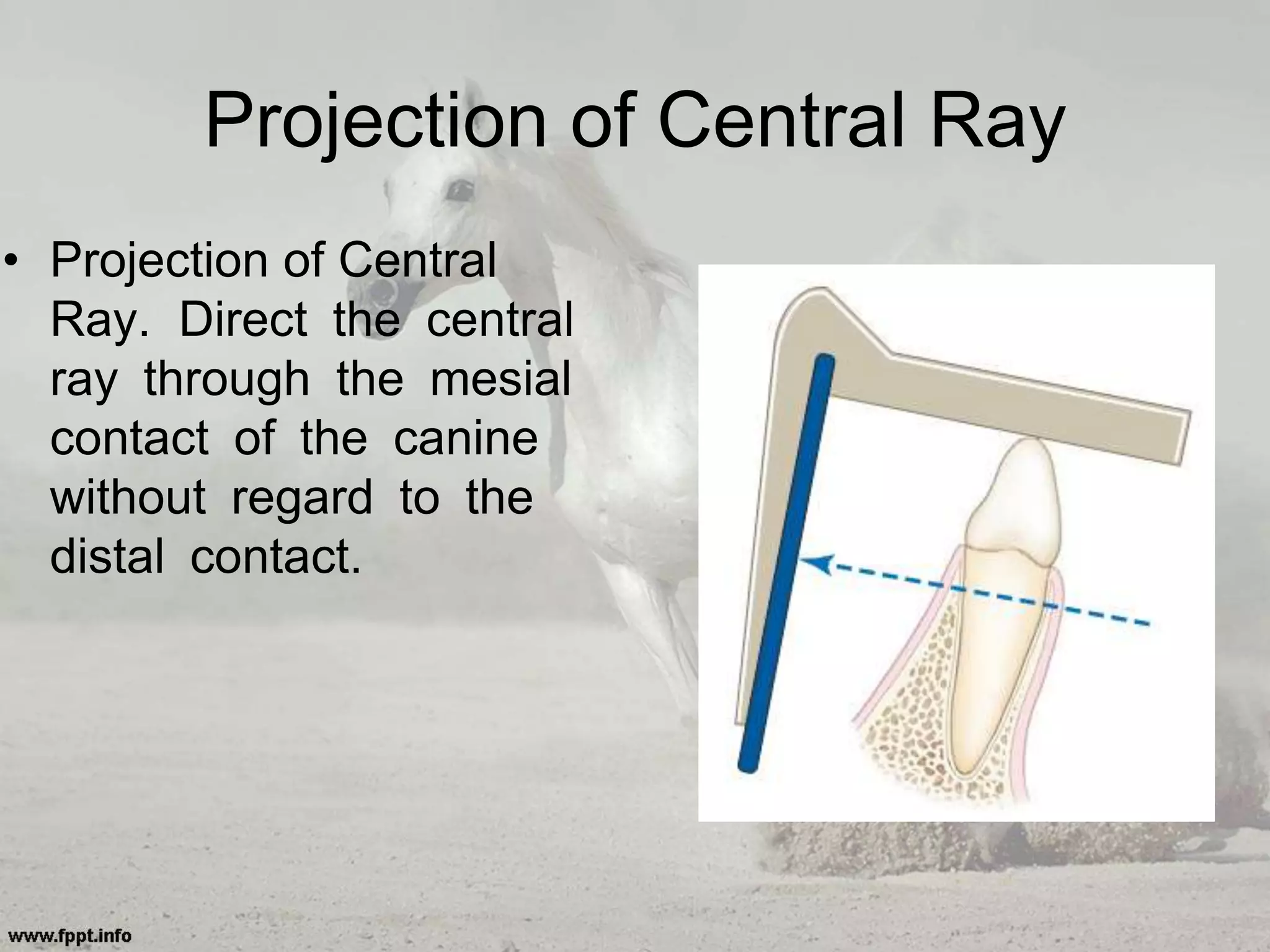 Projection of Central Ray
• Projection of Central
Ray. Direct the central
ray through the mesial
contact of the canine
without regard to the
distal contact.
 