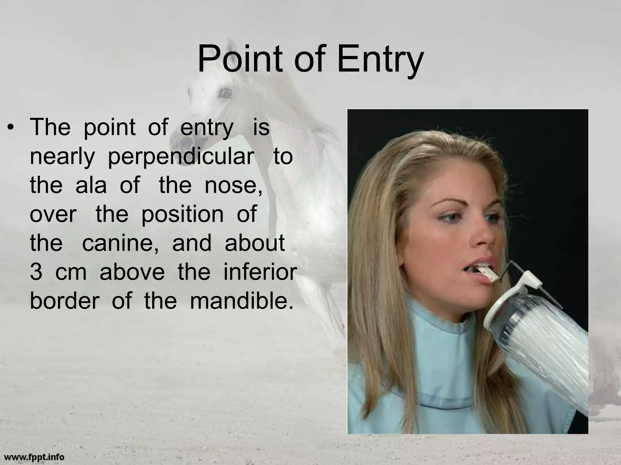Point of Entry
• The point of entry is
nearly perpendicular to
the ala of the nose,
over the position of
the canine, and about
3 cm above the inferior
border of the mandible.
 