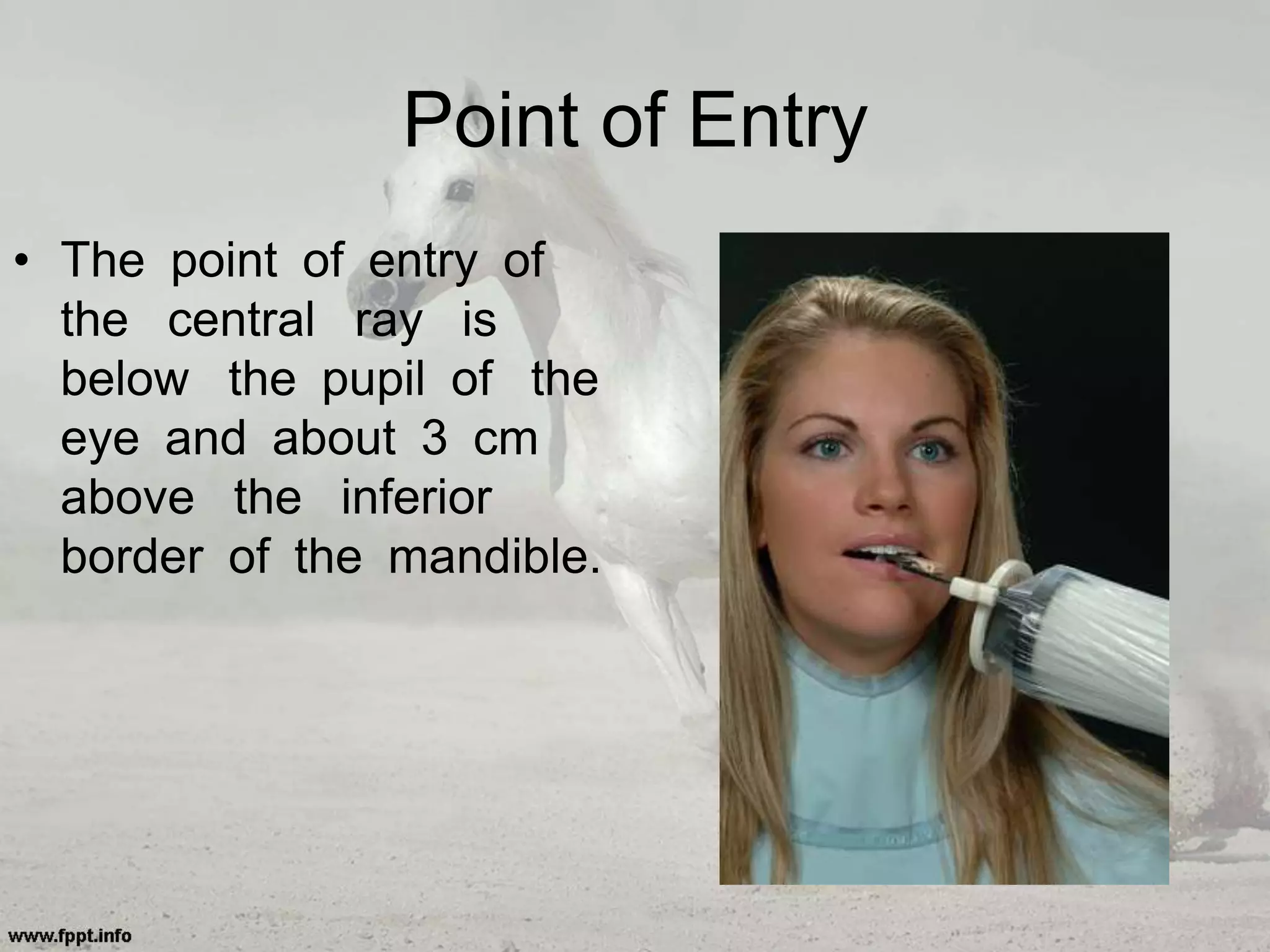 Point of Entry
• The point of entry of
the central ray is
below the pupil of the
eye and about 3 cm
above the inferior
border of the mandible.
 