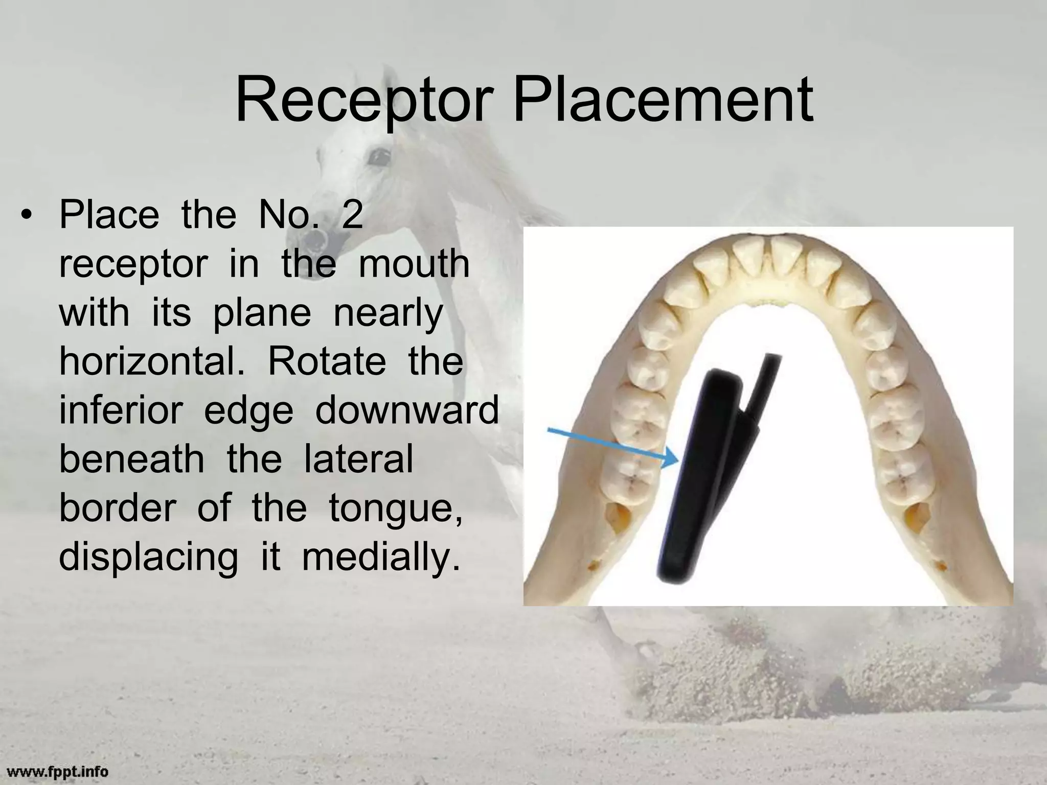Receptor Placement
• Place the No. 2
receptor in the mouth
with its plane nearly
horizontal. Rotate the
inferior edge downward
beneath the lateral
border of the tongue,
displacing it medially.
 