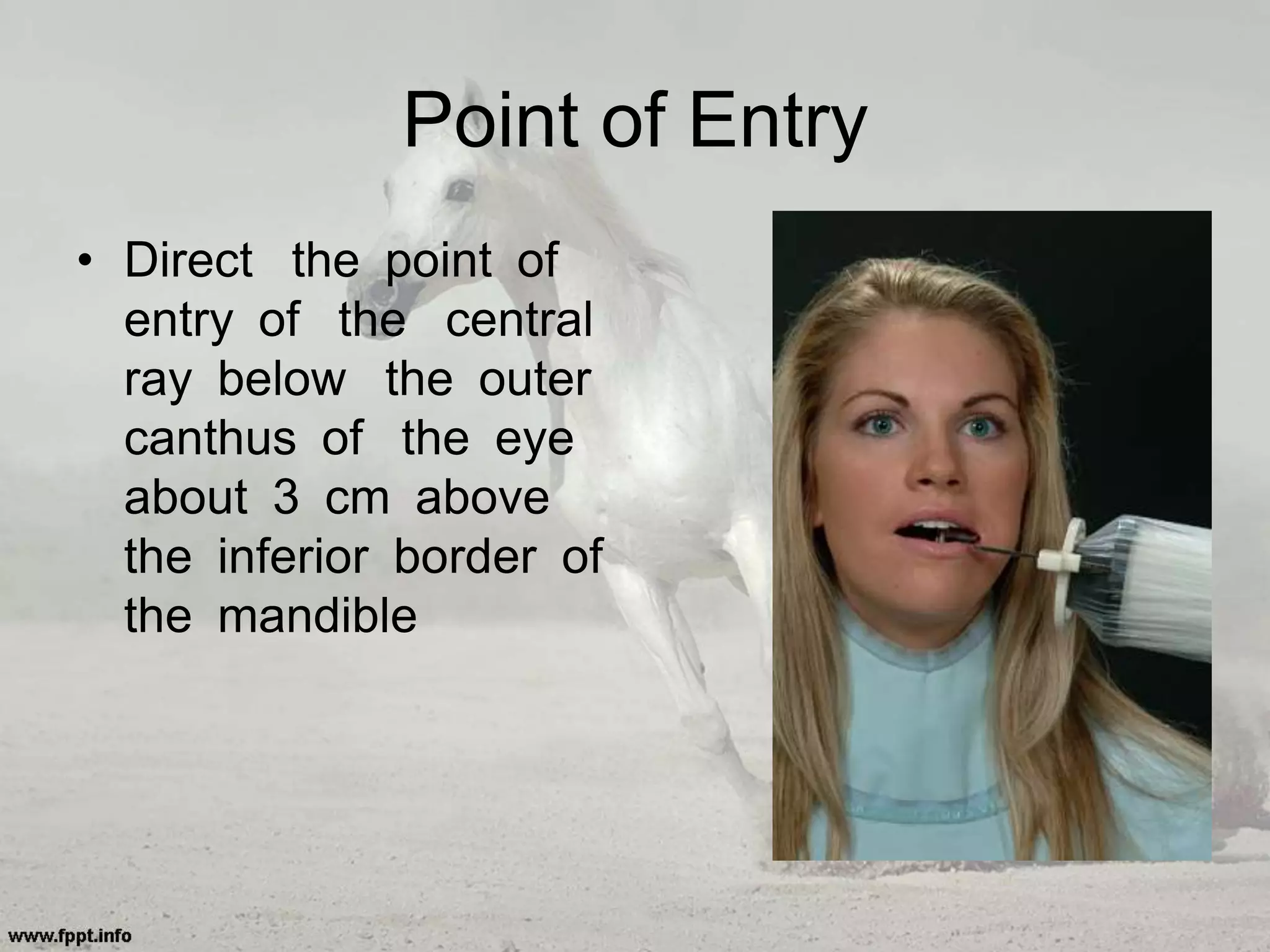 Point of Entry
• Direct the point of
entry of the central
ray below the outer
canthus of the eye
about 3 cm above
the inferior border of
the mandible
 