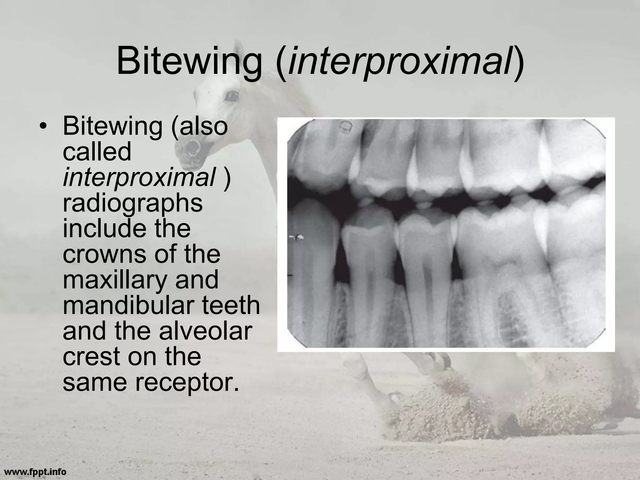 • Bitewing (also
called
interproximal )
radiographs
include the
crowns of the
maxillary and
mandibular teeth
and the alveolar
crest on the
same receptor.
Bitewing (interproximal)
 