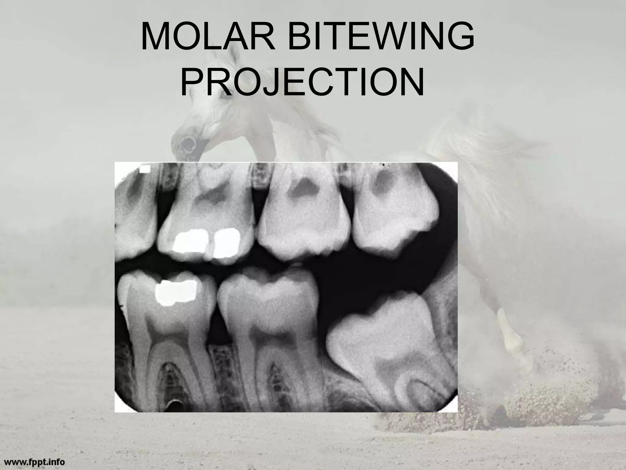 MOLAR BITEWING
PROJECTION
 